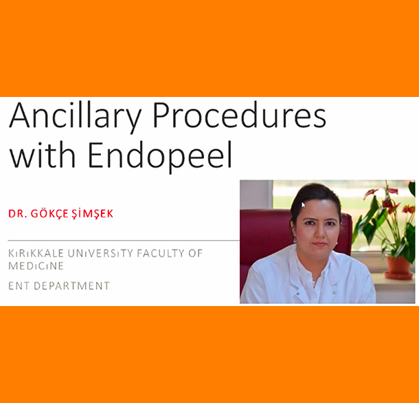 ancillary-endopeel