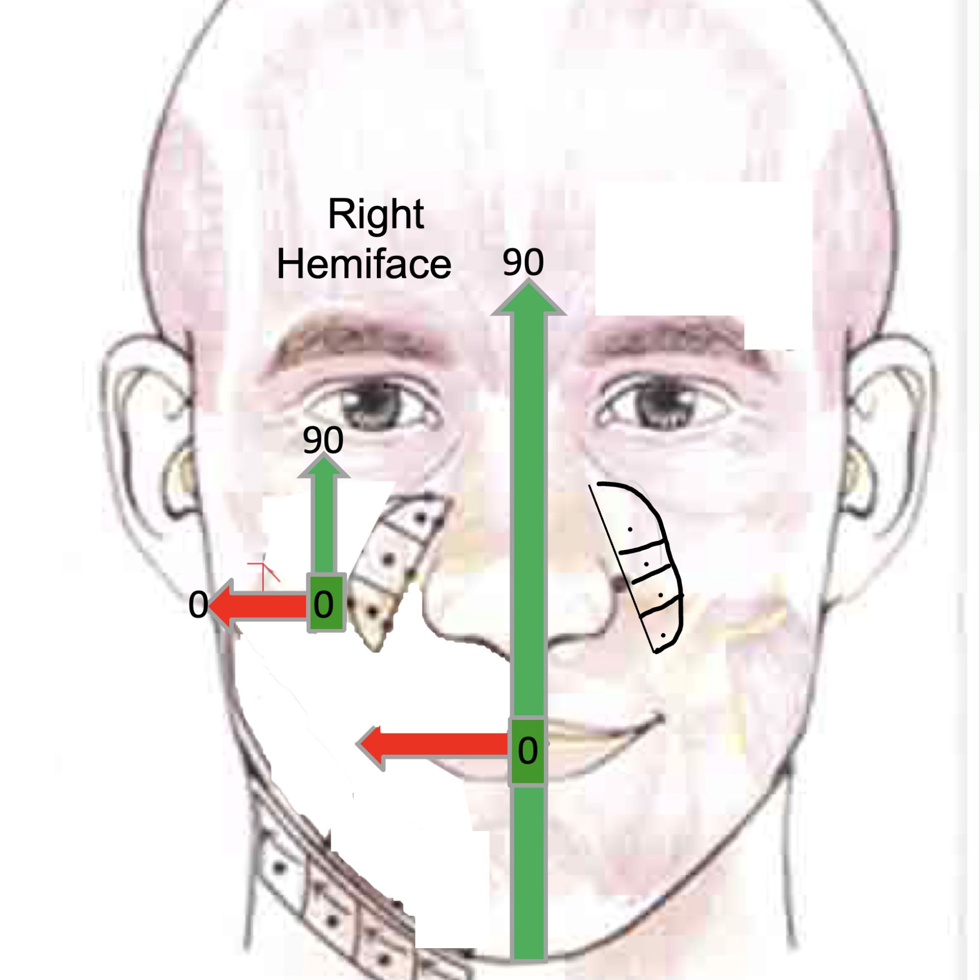 angles work area R hemiface