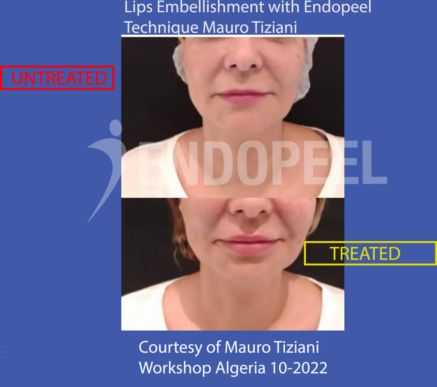 lips embellishment tiziani