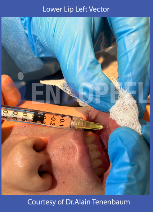 lower lip left vector