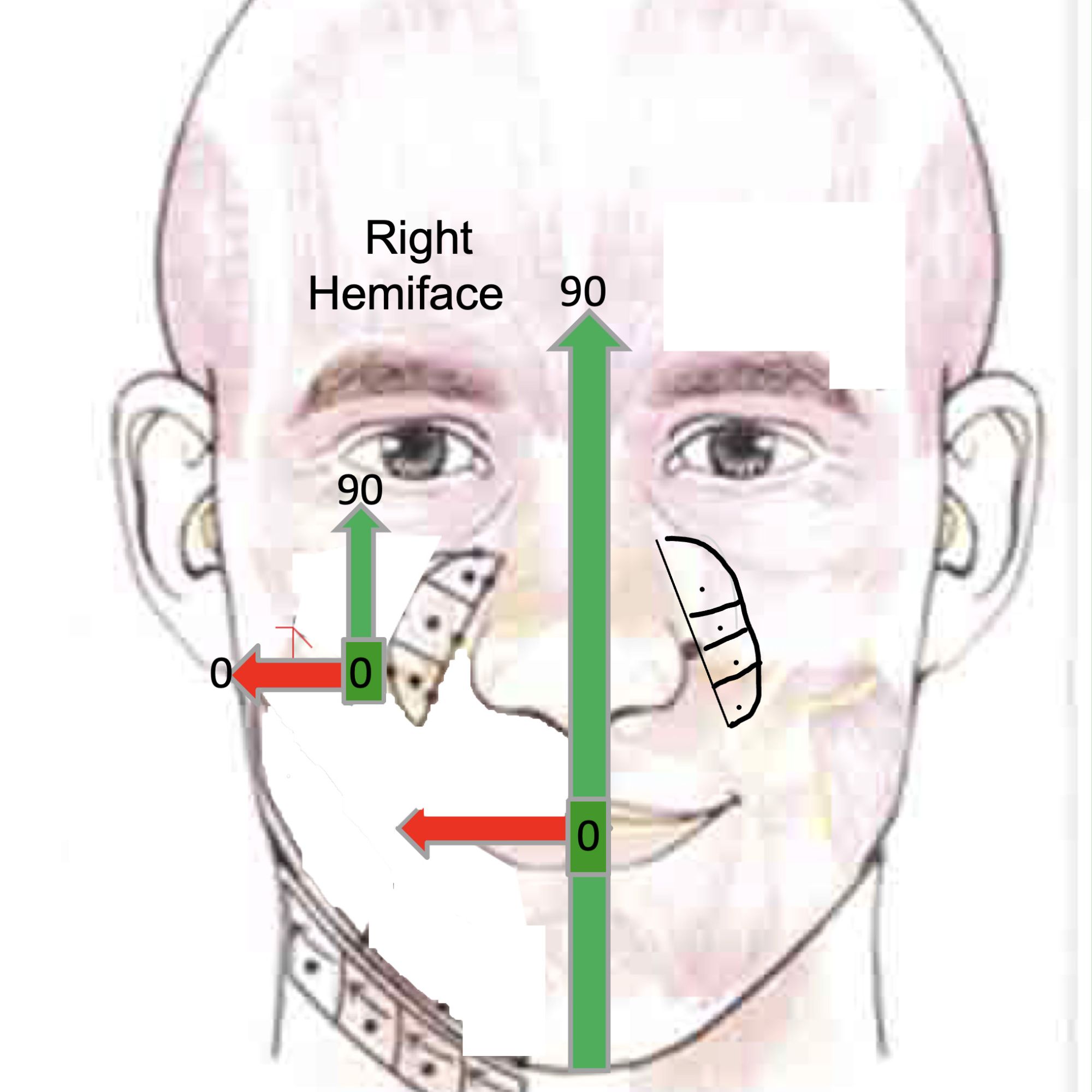 angles work area R hemiface