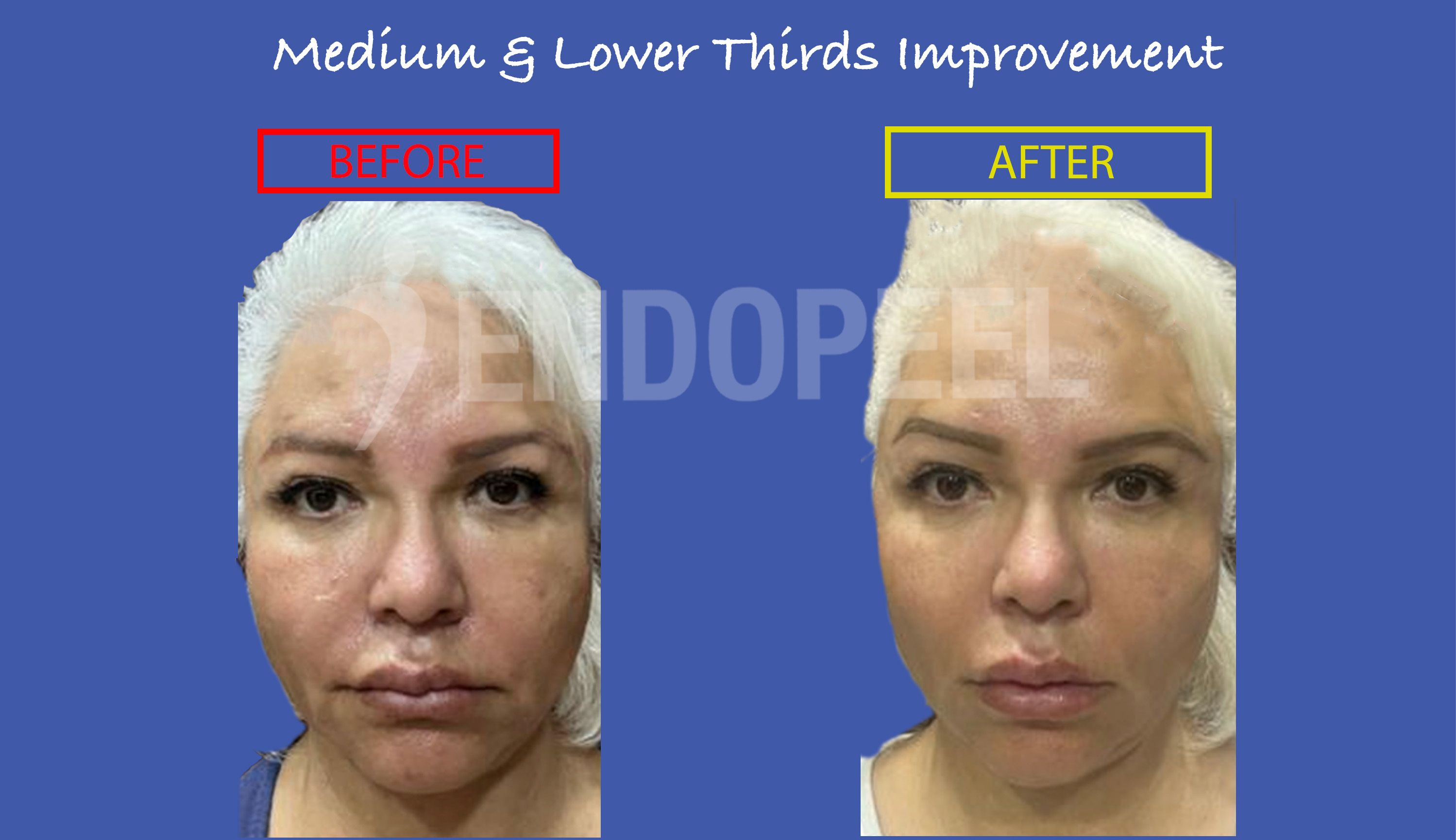 ethnic-indications/mexican-face2