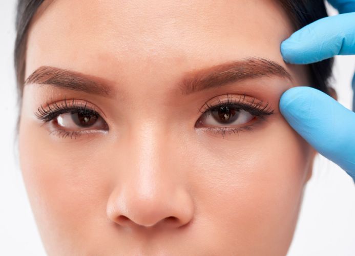 eyebrow-lift-hero