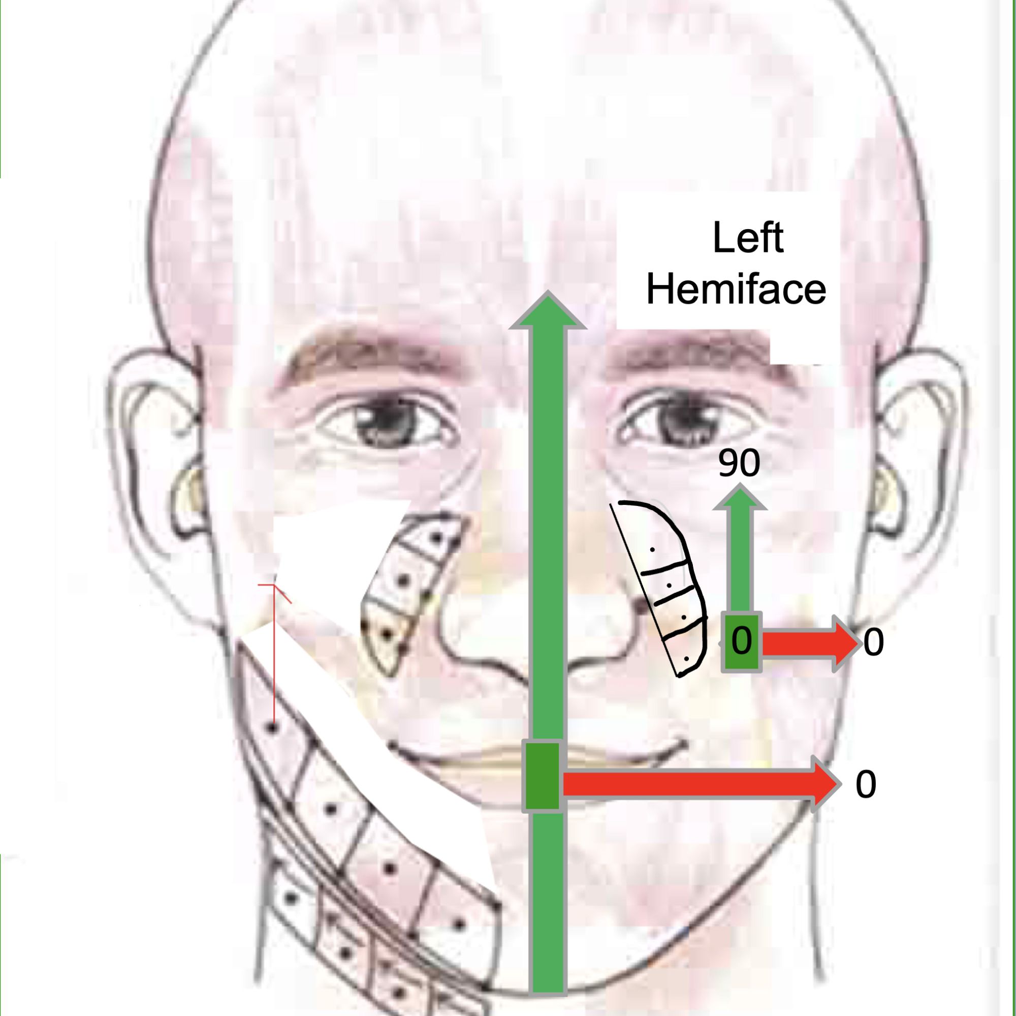 angles work area L hemiface