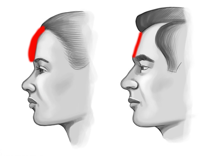profiles forehead lateral view