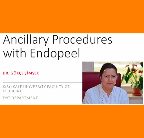 ancillary-endopeel